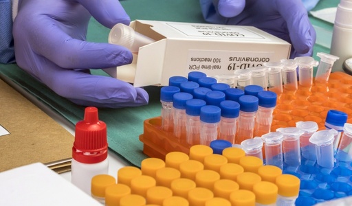 [65-DIGL-100] QuantiChrom™ Glucose Assay Assay 100